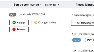 vignette du projet Condor Scan